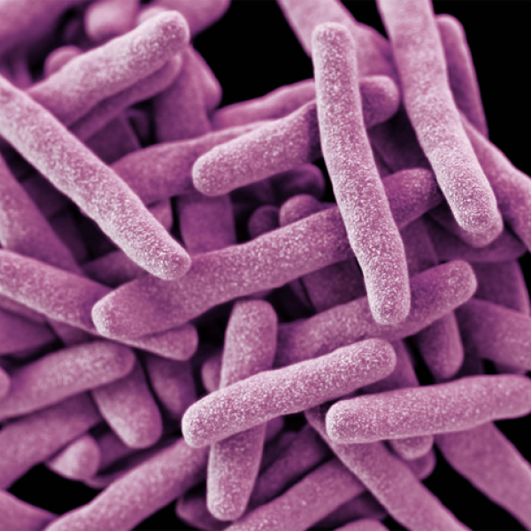 Drug-resistant TB is shown through a microscope